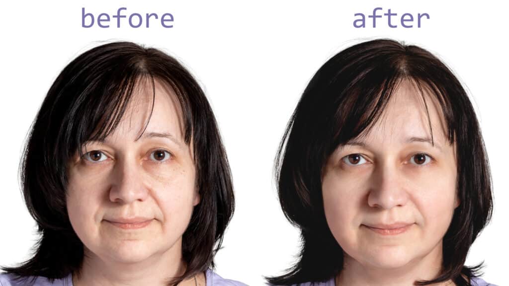 Before and after portraits of a woman, showcasing the effectiveness of Photo Eraser in enhancing facial lighting and features.